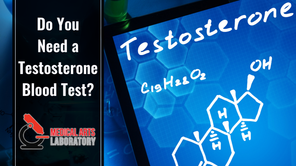 do-you-need-a-testosterone-blood-test-check-your-low-t-levels