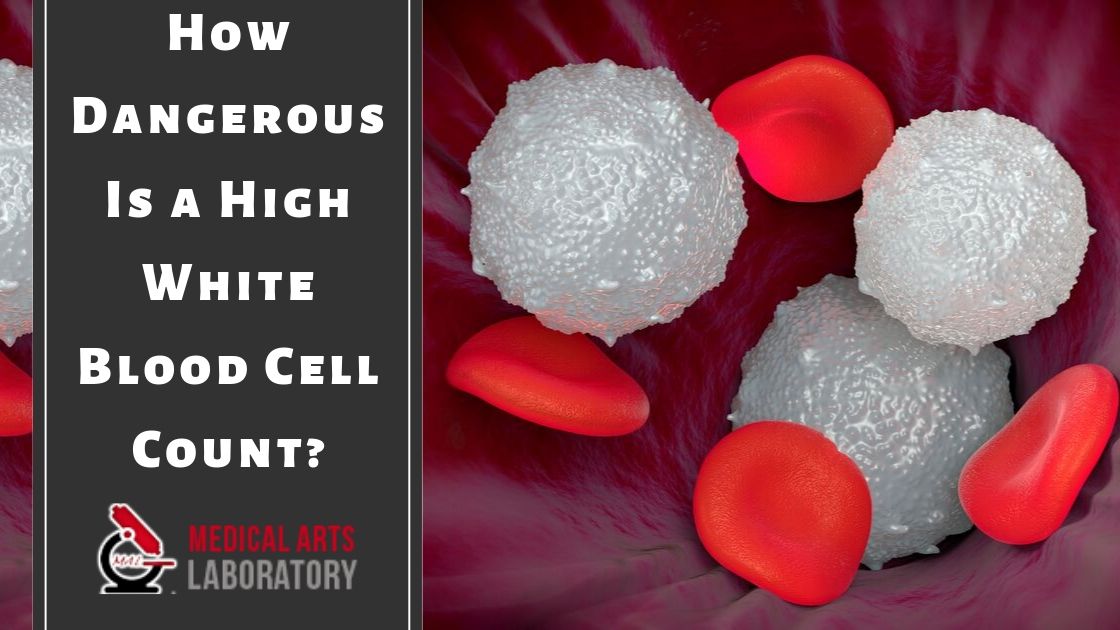 How Dangerous Is a High White Blood Cell Count?