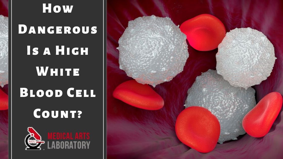 Leukemia Low White Blood Cell Count Range